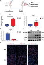 Asporin Antibody in Western Blot (WB)