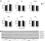 Norepinephrine Transporter Antibody in Western Blot (WB)