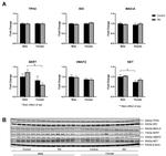 Norepinephrine Transporter Antibody in Western Blot (WB)