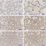 SFTPC Antibody in Immunohistochemistry (Paraffin) (IHC (P))