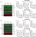 PPME1 Antibody in Western Blot (WB)