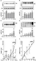 SUMO1 Polyclonal Antibody