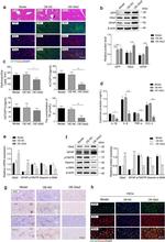 GLIS2 Antibody in Western Blot, Immunohistochemistry (Paraffin) (WB, IHC (P))