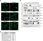 Fibronectin Antibody in Western Blot (WB)