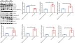 TMPRSS11E Antibody in Western Blot (WB)