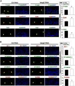 beta Catenin Antibody in Immunohistochemistry, Immunocytochemistry (IHC, ICC/IF)