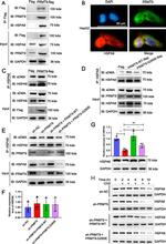 PRMT9 Antibody in Western Blot (WB)