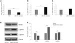 HBE1 Antibody in Western Blot (WB)