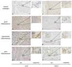 GPR30 Antibody in Immunohistochemistry (IHC)