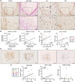 CD20 Antibody in Immunohistochemistry (IHC)