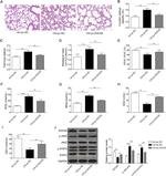 SOCS5 Antibody in Western Blot (WB)