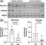 UGT1A6 Antibody in Western Blot (WB)