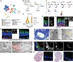 CDH23 Antibody in Immunohistochemistry (Paraffin) (IHC (P))