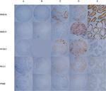 CT83 Antibody in Immunohistochemistry (Paraffin) (IHC (P))