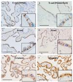 P-cadherin Monoclonal Antibody (PCD-1)