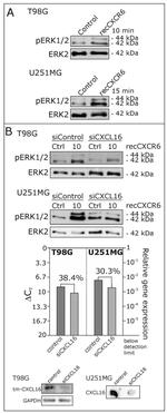 CXCL16 Antibody in Western Blot (WB)