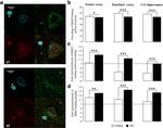MAP2 Antibody in Immunocytochemistry (ICC/IF)