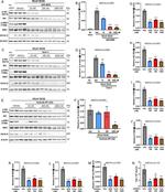Coronavirus Spike Protein Antibody in Western Blot (WB)
