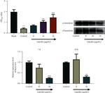 Delta-hemolysin Antibody in Western Blot (WB)