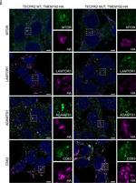 Mouse IgG (H+L) Cross-Adsorbed Secondary Antibody in Immunocytochemistry (ICC/IF)