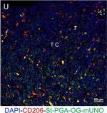 Rat IgG (H+L) Cross-Adsorbed Secondary Antibody in Immunohistochemistry (IHC)
