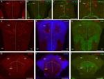 HuC/HuD Antibody in Immunohistochemistry (IHC)
