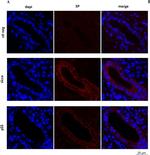 Mouse IgG (H+L) Highly Cross-Adsorbed Secondary Antibody in Immunohistochemistry (IHC)