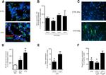 E-cadherin Antibody in Immunohistochemistry (IHC)