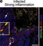Rabbit IgG (H+L) Cross-Adsorbed Secondary Antibody in Immunohistochemistry (IHC)