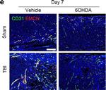 Rat IgG (H+L) Secondary Antibody in Immunohistochemistry (IHC)
