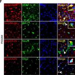Goat IgG (H+L) Cross-Adsorbed Secondary Antibody in Immunohistochemistry (IHC)