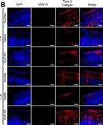 Mouse IgG (H+L) Cross-Adsorbed Secondary Antibody in Immunohistochemistry (IHC)