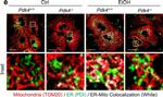 Rabbit IgG (H+L) Cross-Adsorbed Secondary Antibody in Immunocytochemistry (ICC/IF)