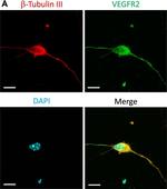 Mouse IgG (H+L) Highly Cross-Adsorbed Secondary Antibody in Immunocytochemistry (ICC/IF)