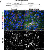 Mouse IgG (H+L) Highly Cross-Adsorbed Secondary Antibody in Immunocytochemistry (ICC/IF)