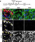 Mouse IgG (H+L) Highly Cross-Adsorbed Secondary Antibody in Immunocytochemistry (ICC/IF)