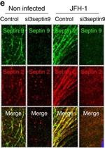Mouse IgG2a Cross-Adsorbed Secondary Antibody in Immunocytochemistry (ICC/IF)