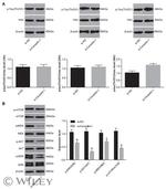 Phospho-Tau (Thr231) Antibody in Western Blot (WB)
