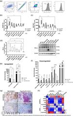 FOXP3 Antibody in Immunohistochemistry (IHC)