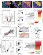c-Met Antibody in Immunohistochemistry (IHC)