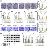 Cyclin D1 Antibody in Western Blot (WB)