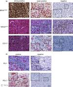 c-Kit Antibody in Immunohistochemistry (IHC)