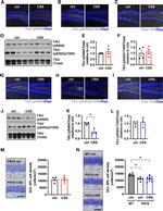 Phospho-Tau (Ser404) Antibody in Western Blot (WB)