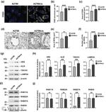 LAMP-2A Antibody in Western Blot (WB)
