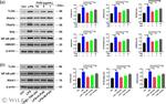IKK beta Antibody in Western Blot (WB)