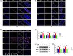 BACE1 Antibody in Western Blot (WB)