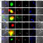 LAMP1 Antibody in Immunocytochemistry (ICC/IF)