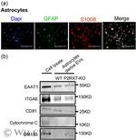 S100B Antibody in Immunocytochemistry (ICC/IF)
