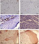 TGF beta-1 Antibody in Immunohistochemistry (IHC)