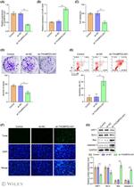 Bcl-2 Antibody in Western Blot (WB)